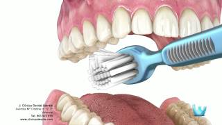 Higiene dental  Clinica identis [upl. by Euginomod]