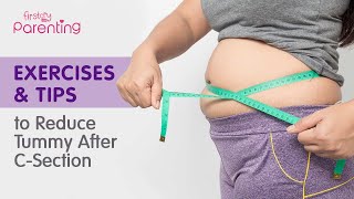 How to Reduce Tummy Fat After Csection Delivery Easy Exercises amp Tips [upl. by Lehcsreh]