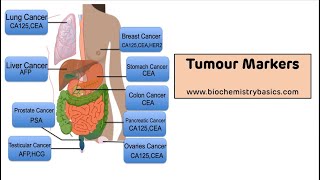 Tumour Markers  Tumour Markers Biochemistry [upl. by Patricia]