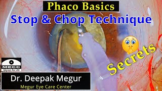 Phaco Basics  Stop amp Chop technique Re visited  Dr Deepak Megur [upl. by Silado50]