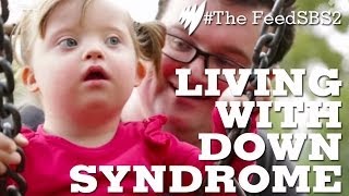 Down Syndrome Life [upl. by Seena]