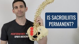 Is Sacroiliitis Permanent [upl. by Ecinue]