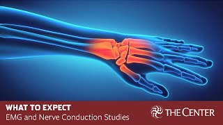 What to Expect During Nerve Conduction Studies and EMG Tests [upl. by Banyaz177]