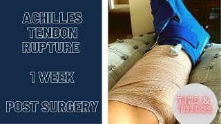 Achilles Tendon Rupture  1 Week  POST SURGERY  2021 [upl. by Ahsercul]