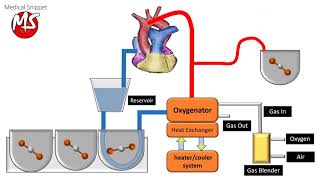 Cardiopulmonary bypass CPB circuit [upl. by Kristoforo]