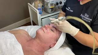 Microdermabrasion Facial Demonstration [upl. by Hawkie]