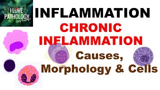 INFLAMMATION 8 CHRONIC INFLAMMATION Causes Morphology amp Cells [upl. by Lynelle]