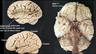 Lateral sulcus [upl. by Airet185]