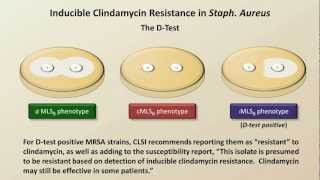 Campylobacter jejuni GI infection [upl. by Elay837]