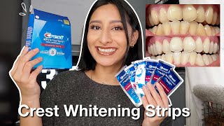 I TRIED THE CREST 3D WHITESTRIPS FOR 14 DAYS Effective  Before amp After pictures [upl. by Narf]