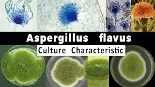 Aspergillus Flavus Culture Characteristic [upl. by Payson273]