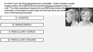 Immunodeficiency Syndromes USMLE Questions [upl. by Mcnamara]