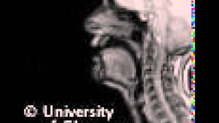 MRI voiced pharyngeal fricative [upl. by Philine578]