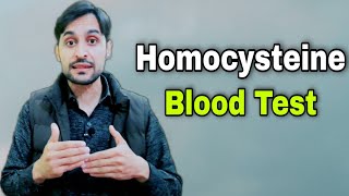 Homocysteine Blood Test  Homocysteine Metabolism [upl. by Nauhs]