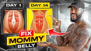 FIX MOMMY BELLY  2 WEEKS DO THIS EVERYDAY [upl. by Lathrop]