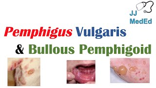 Vesiculobullous Skin Diseases  Pemphigus Vulgaris vs Bullous Pemphigoid [upl. by Colbye]