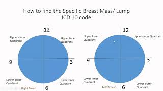 ICD 10 Coding Guide for Breast MassLump N63 series [upl. by Nelli]