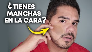 ¿POR QUÉ Aparecen las MANCHAS EN LA PIEL Explicación y SOLUCIONES MÉDICAS [upl. by Yesnik]