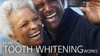 How Tooth Whitening Works [upl. by Fernyak]