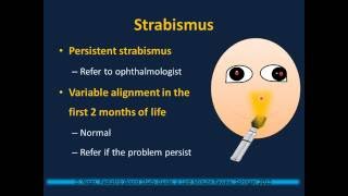 Newborn Examination Neonatology II [upl. by Davidson351]