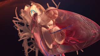 Le pôle urgencesréanimationpédiatriecardiologie [upl. by Nanyt751]