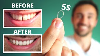 DIY CLOSE GAP TEETH AT HOME  My Update [upl. by Camilia]