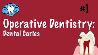 Operative Dentistry  Dental Caries  INBDE ADAT [upl. by Yrrab]