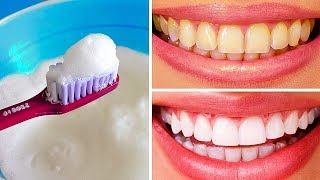 10 Natural Ways to Whiten Teeth at Home [upl. by Shiff]