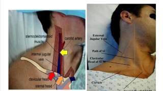 Jugular venous pulse anatomical aspects [upl. by Lareneg]