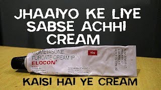 Elocon Cream Honest Review After Using 20 Days  Best Cream For Melasma In India [upl. by Rebe68]