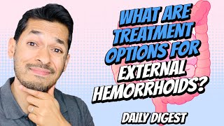 What Are Treatment Options For External Hemorrhoids [upl. by Eniotna4]