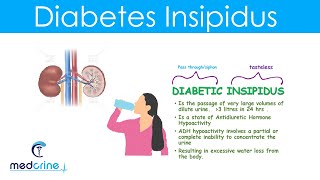 Diabetes Insipidus DI Causes Symptoms Diagnosis and treatment [upl. by Deming768]