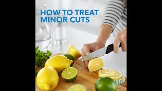 How to treat minor cuts [upl. by Fraze]