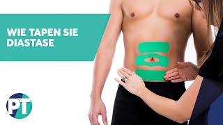 Wie tapen Sie Diastase  Medical Taping  PhysioTape [upl. by Jung]