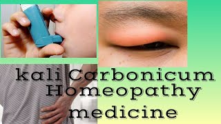 Kali Carbonicum homeopathy medicine in hindi by Premwati Yadav [upl. by Imeka943]