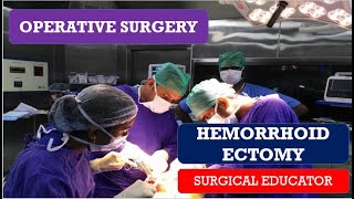 HEMORRHOIDECTOMYSTEP BY STEP OPERATIVE SURGERY [upl. by Gabriel]