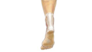 Achilles Tendon Repair Surgery PreOp® Patient Education [upl. by Olive]