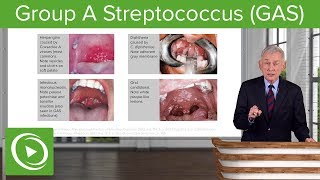 Group A Streptococcus GAS – Infectious Diseases  Lecturio [upl. by Nnaytsirk]