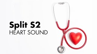 Fixed Split S2  Heart Sounds  MEDZCOOL [upl. by Hgielyk]