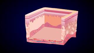 Knee Cartilage Damage Treatment  ChondralOsteochondral Defect Treatment Explained in Detail [upl. by Julis]