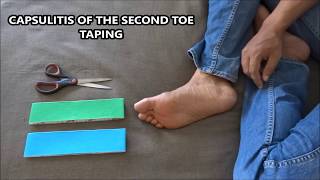 Capsulitis of the second toe taping [upl. by Assenav164]