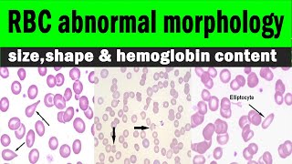 Red blood cells  RBC abnormal morphology  sizeshape amp hemoglobin content  Hematology [upl. by Ulrikaumeko627]