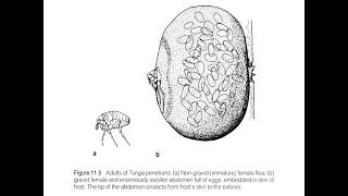 Jigger’s disease [upl. by Mendel]