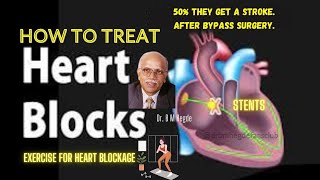 How to Treat Heart Blockages  Dr B M Hegde [upl. by Atilahs]