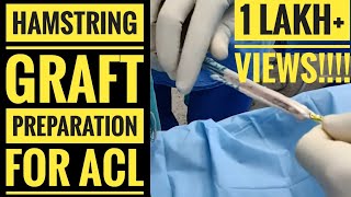 Explain the Process of Skin Grafting [upl. by Halie]