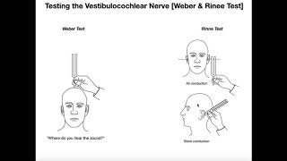 Interpreting the WeberRinne Tests EXPLAINED [upl. by Pren89]