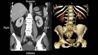 Ureter  Anatomy  Complete [upl. by Finegan]