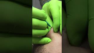 Microdermal piercing [upl. by Verlie]