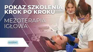 Mezoterapia Igłowa I Szkolenie medycyny estetycznej  KROK PO KROKU [upl. by Eboh295]