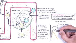 Epstein Barr Virus and Infectious Mononucleosis pathophysiology investigations and treatment [upl. by Aiblis]